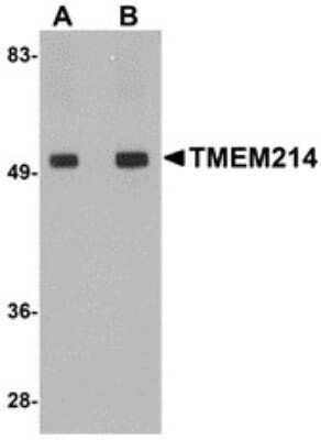 Western Blot: TMEM214 AntibodyBSA Free [NBP2-82034]