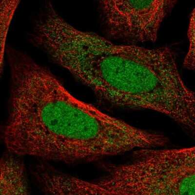 Immunocytochemistry/ Immunofluorescence: TMEM215 Antibody [NBP2-14772]