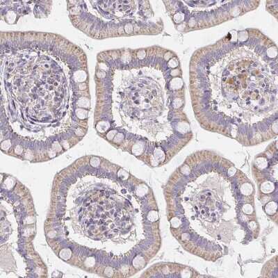 Immunohistochemistry-Paraffin: TMEM219 Antibody [NBP2-32439]