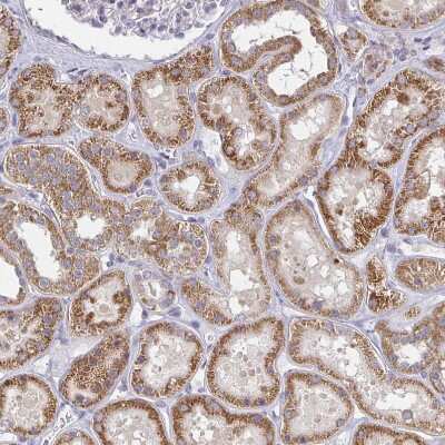 Immunohistochemistry-Paraffin: TMEM219 Antibody [NBP2-32439]