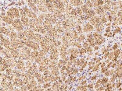 Immunohistochemistry-Paraffin: TMEM230 Antibody [NBP3-12700]