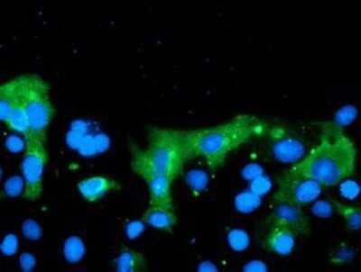 Immunocytochemistry/ Immunofluorescence: TMEM230 Antibody (OTI2C8) - Azide and BSA Free [NBP2-71847]