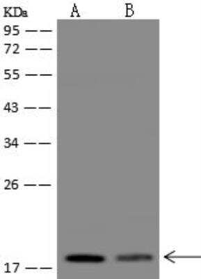 Western Blot: TMEM230 Antibody [NBP3-12700]