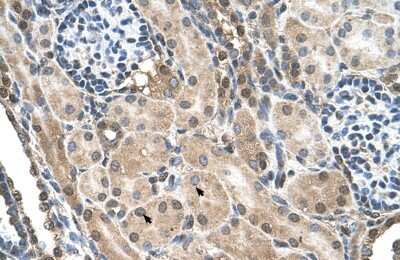 Immunohistochemistry-Paraffin: TMEM231 Antibody [NBP1-59823]