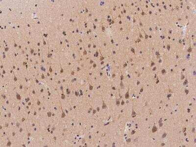 Immunohistochemistry-Paraffin: TMEM231 Antibody [NBP3-06280]