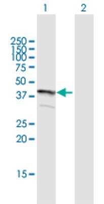 Western Blot: TMEM231 Antibody [H00079583-B01P]