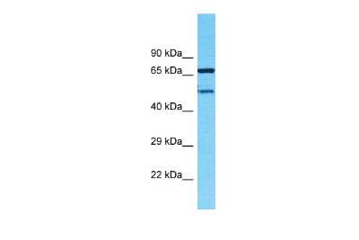 Western Blot: TMEM232 Antibody [NBP2-83686]