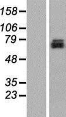 Western Blot: TMEM24 Overexpression Lysate [NBP2-10305]