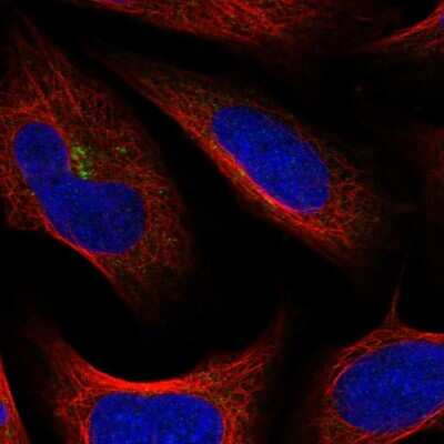 Immunocytochemistry/ Immunofluorescence: TMEM241 Antibody [NBP2-56668]