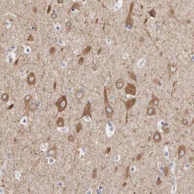 Immunohistochemistry-Paraffin: TMEM242 Antibody [NBP1-88580]