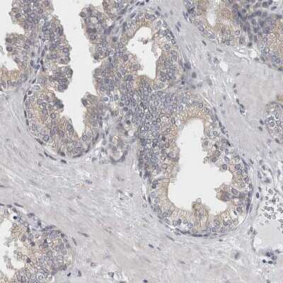 Immunohistochemistry-Paraffin: TMEM242 Antibody [NBP1-88580]
