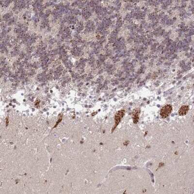 Immunohistochemistry-Paraffin: TMEM246 Antibody [NBP2-33702]