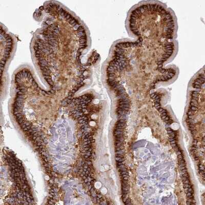 Immunohistochemistry-Paraffin: TMEM253 Antibody [NBP2-14768]
