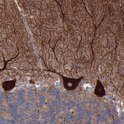 Immunohistochemistry-Paraffin: TMEM268 Antibody [NBP1-90535]