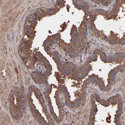 Immunohistochemistry-Paraffin: TMEM268 Antibody [NBP1-90535]