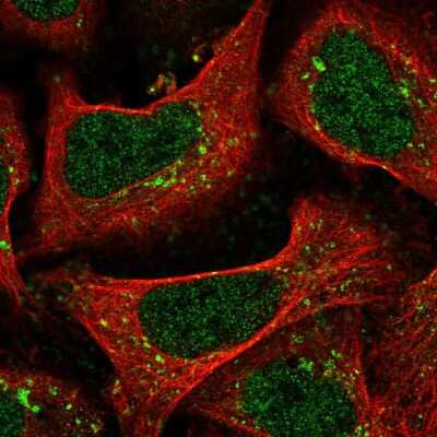 Immunocytochemistry/ Immunofluorescence: TMEM34 Antibody [NBP2-30760]