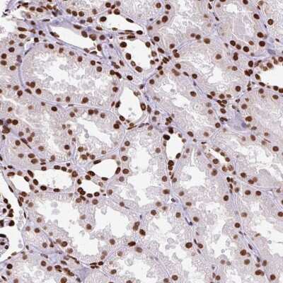 Immunohistochemistry: TMEM34 Antibody [NBP2-30760]