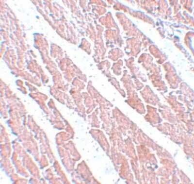 Immunohistochemistry-Paraffin: TMEM34 Antibody - BSA Free [NBP1-77144]