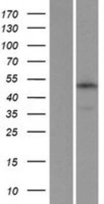 Western Blot: TMEM34 Overexpression Lysate [NBP2-06834]
