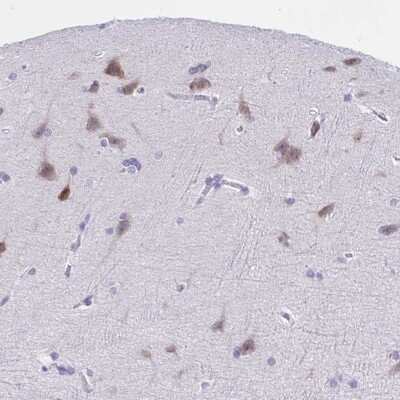 Immunohistochemistry-Paraffin: TMEM35 Antibody [NBP2-31877]