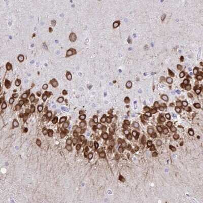 Immunohistochemistry-Paraffin: TMEM35 Antibody [NBP2-31877]