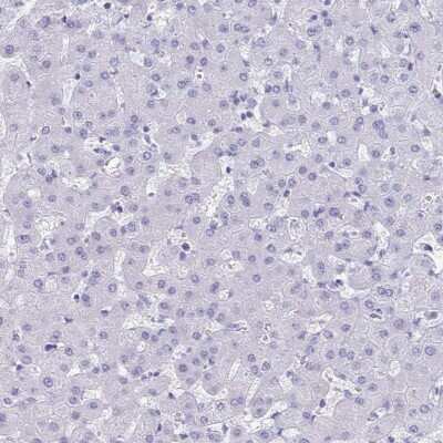 Immunohistochemistry-Paraffin: TMEM35 Antibody [NBP2-31877]