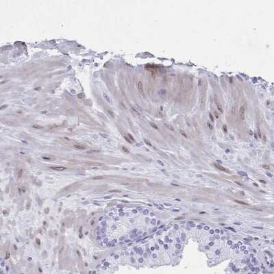 Immunohistochemistry-Paraffin: TMEM35 Antibody [NBP2-31877]