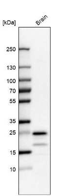 Western Blot: TMEM35 Antibody [NBP2-31877]