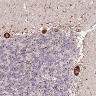 Immunohistochemistry-Paraffin: TMEM38A Antibody [NBP2-13452]