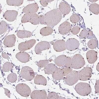 Immunohistochemistry-Paraffin: TMEM38A Antibody [NBP2-13452]