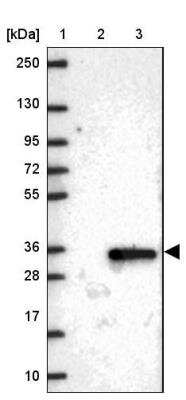 Western Blot: TMEM38A Antibody [NBP2-13452]