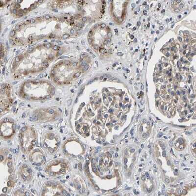 Immunohistochemistry-Paraffin: TMEM38B Antibody [NBP1-88803]