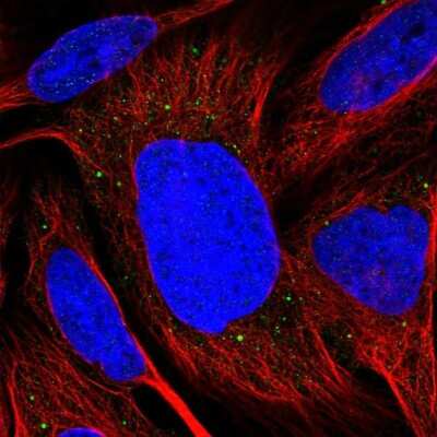 Immunocytochemistry/ Immunofluorescence: TMEM39B Antibody [NBP1-83869]