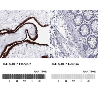Immunohistochemistry-Paraffin: TMEM40 Antibody [NBP3-17144]