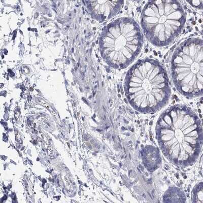 Immunohistochemistry-Paraffin: TMEM40 Antibody [NBP3-17144]