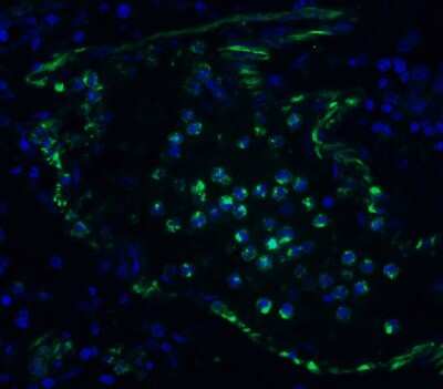 Immunohistochemistry: TMEM41B Antibody - BSA Free [NBP3-12857]