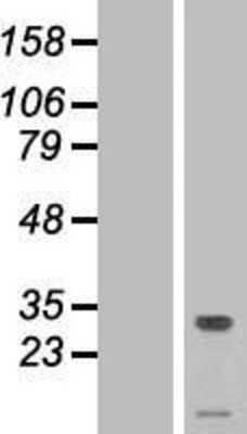 Western Blot: TMEM50A Overexpression Lysate [NBL1-17086]