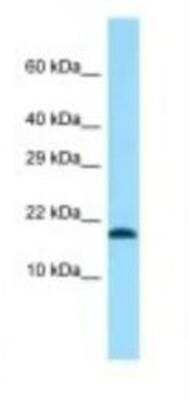 Western Blot: TMEM50B Antibody [NBP1-98461]