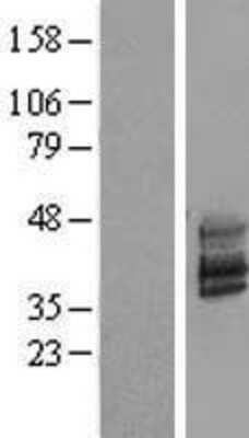 Western Blot: TMEM51 Overexpression Lysate [NBL1-17088]