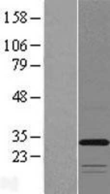 Western Blot: TMEM53 Overexpression Lysate [NBL1-17089]