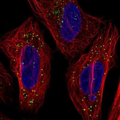 Immunocytochemistry/ Immunofluorescence: TMEM54 Antibody [NBP2-56844]