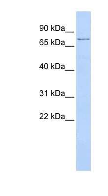 Western Blot: TMEM57 Antibody [NBP1-59709]