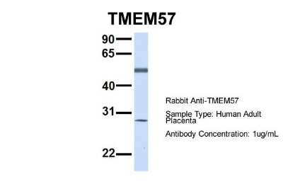 Western Blot: TMEM57 Antibody [NBP1-59709]
