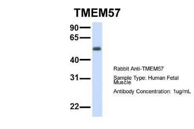 Western Blot: TMEM57 Antibody [NBP1-59709]