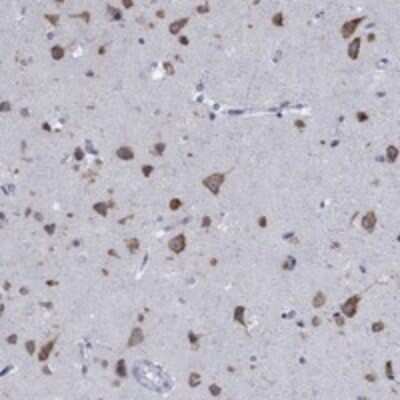 Immunohistochemistry-Paraffin: TMEM59 Antibody [NBP3-17950]