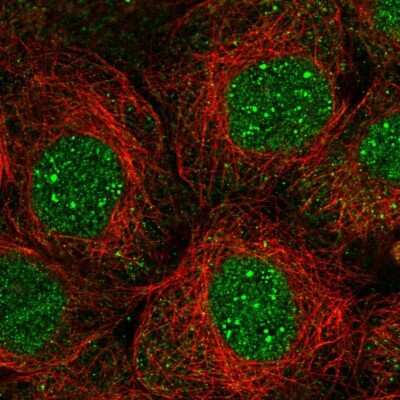 Immunocytochemistry/ Immunofluorescence: TMEM62 Antibody [NBP2-56585]