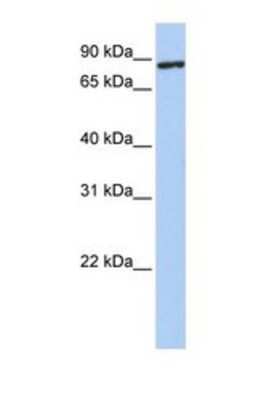 Western Blot: TMEM63A Antibody [NBP1-69249]