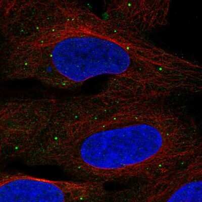 Immunocytochemistry/ Immunofluorescence: TMEM68 Antibody [NBP1-82000]