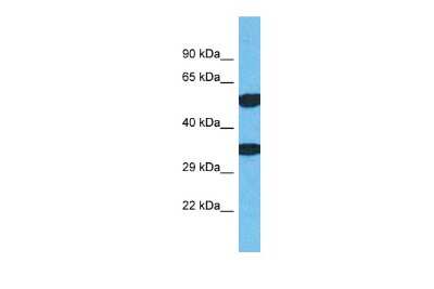 Western Blot: TMEM68 Antibody [NBP2-85951]
