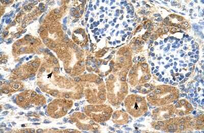 Immunohistochemistry: TMEM69 Antibody [NBP2-83697]
